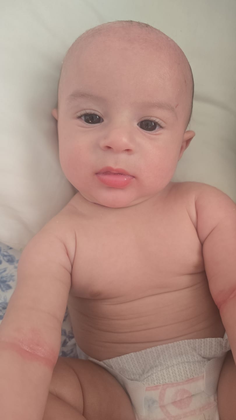 Customer photo review of Flare Up Free Bundle