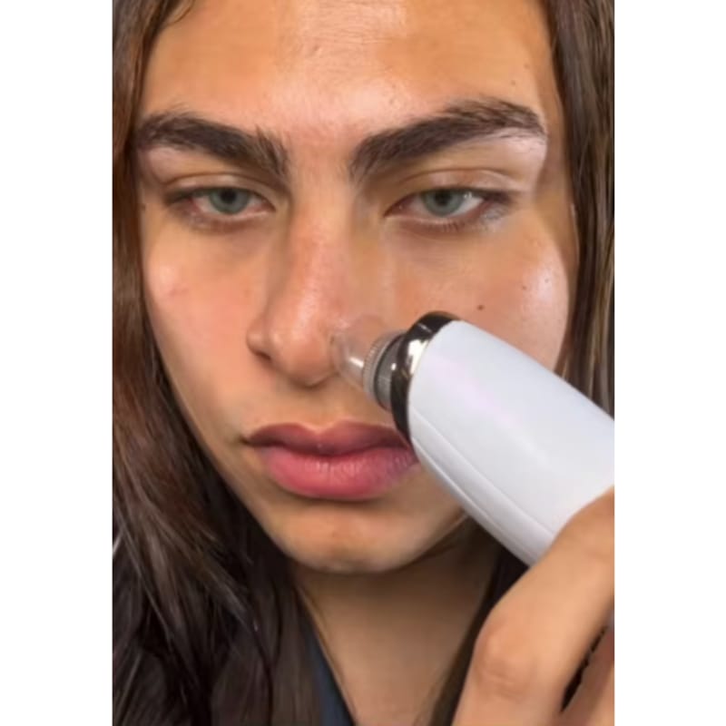 Customer photo review of הערכה המלאה של SkinLight