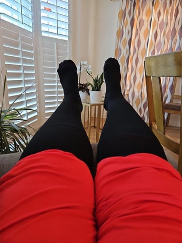 Customer photo review of Original Wide Compression Socks