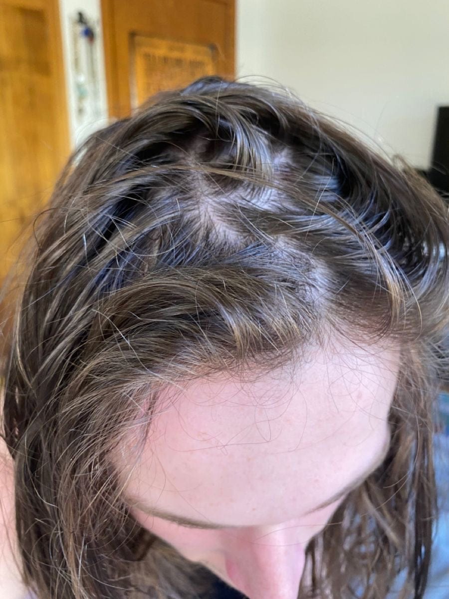 Customer photo review of Grau-Abdeck Farbshampoo