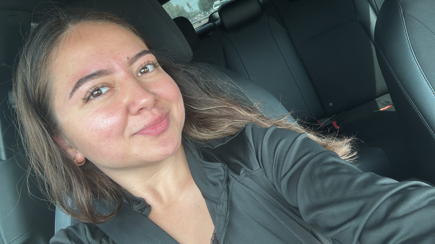 Customer photo review of Quick sunstick Protection bar