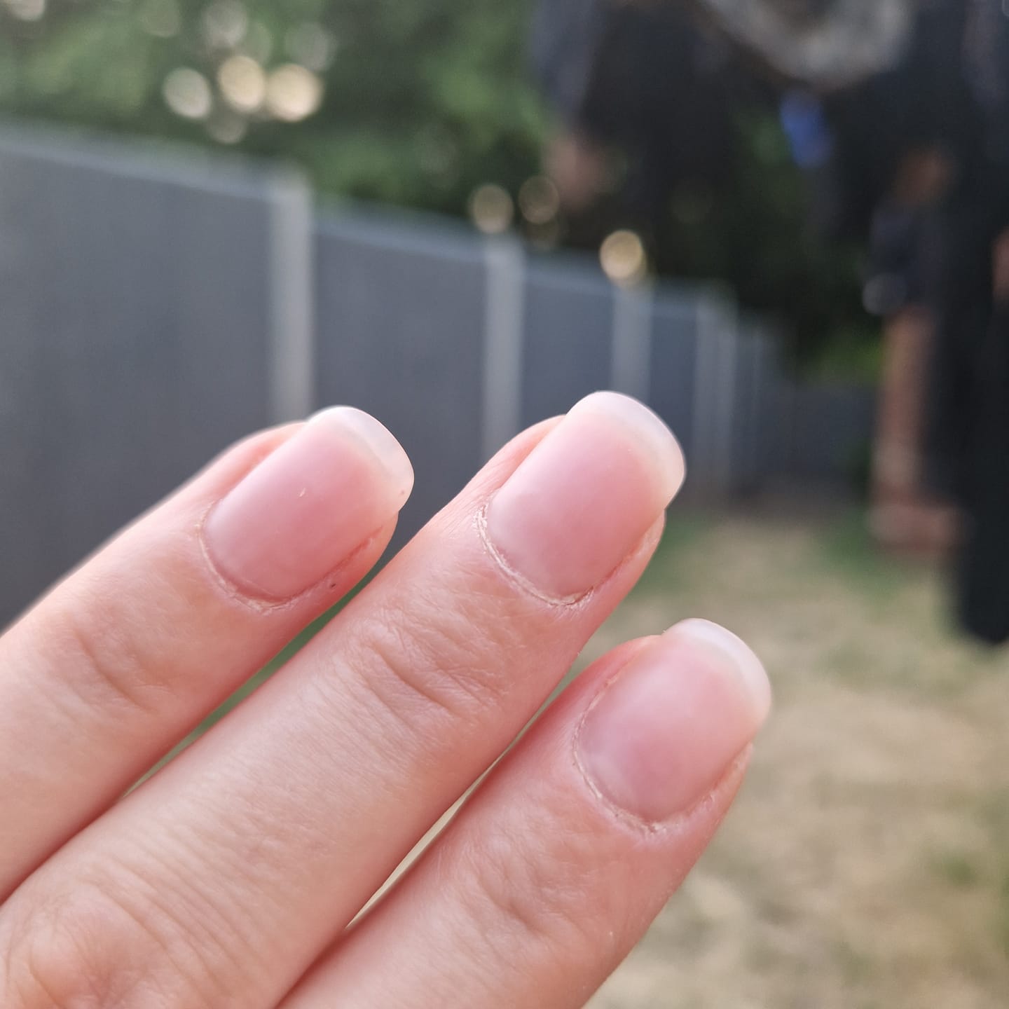 Customer photo review of Semilac Care Base UV Gel Polish