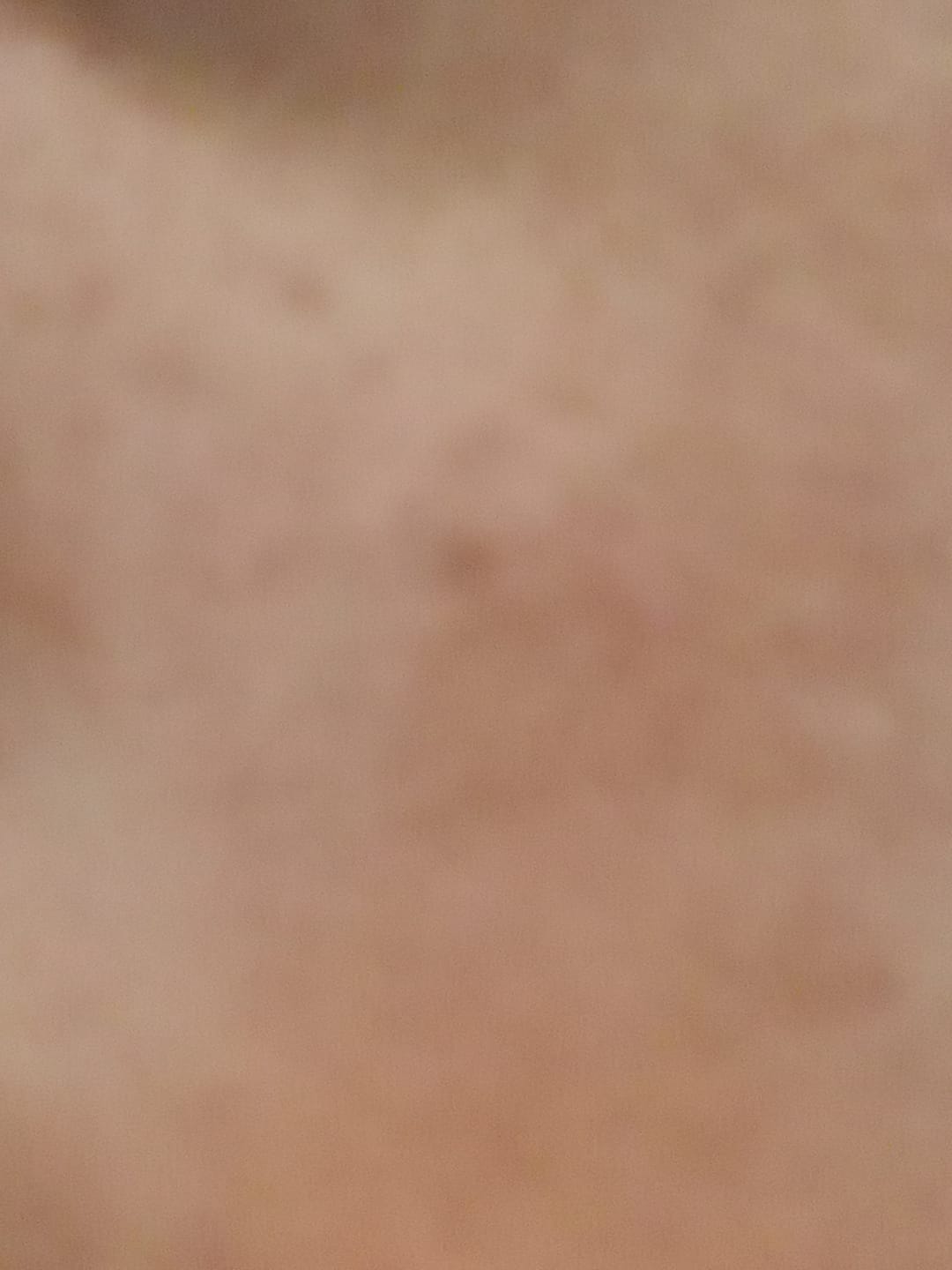 Customer photo review of Niacinamide Pigmentation Cream