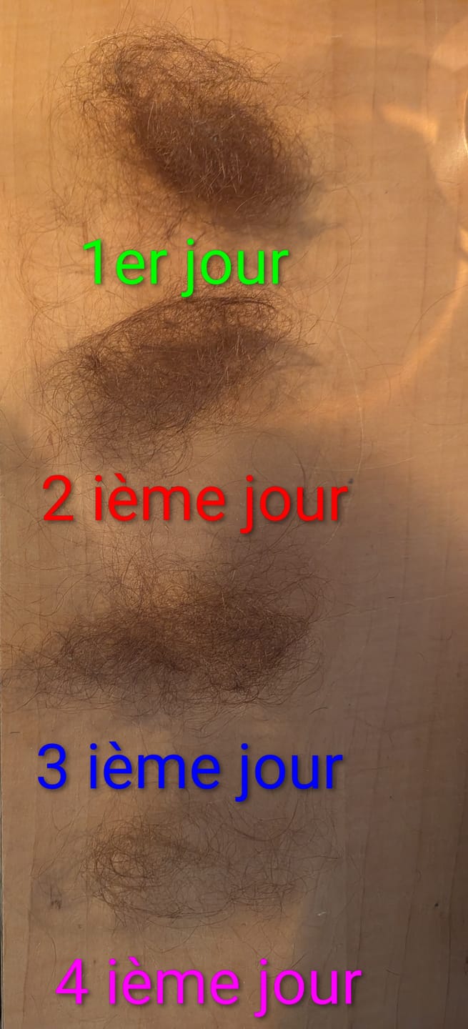 Customer photo review of SÉRUM NATUREL AU ROMARIN — LE SOIN CIBLÉ QUI AGIT PENDANT DES HEURES