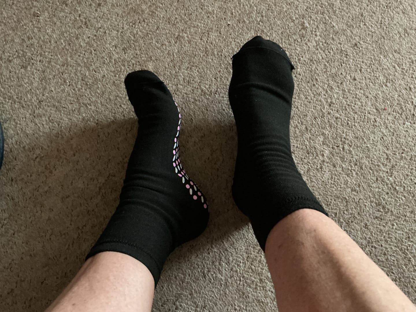 Customer photo review of Vitalkompass – Neurosocken (Neuropathie Sommer Socken)