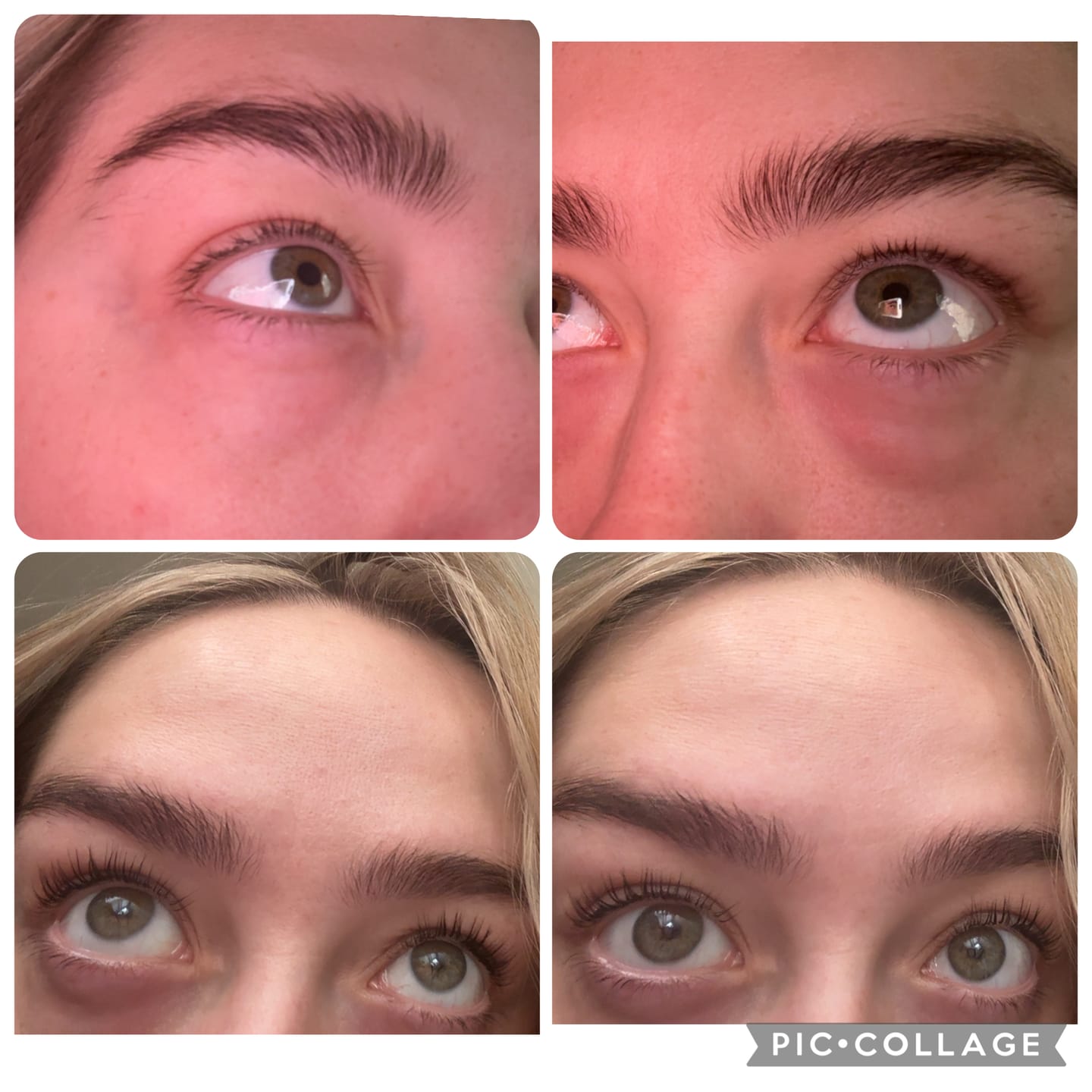 Customer photo review of The Lash Rehab Duo