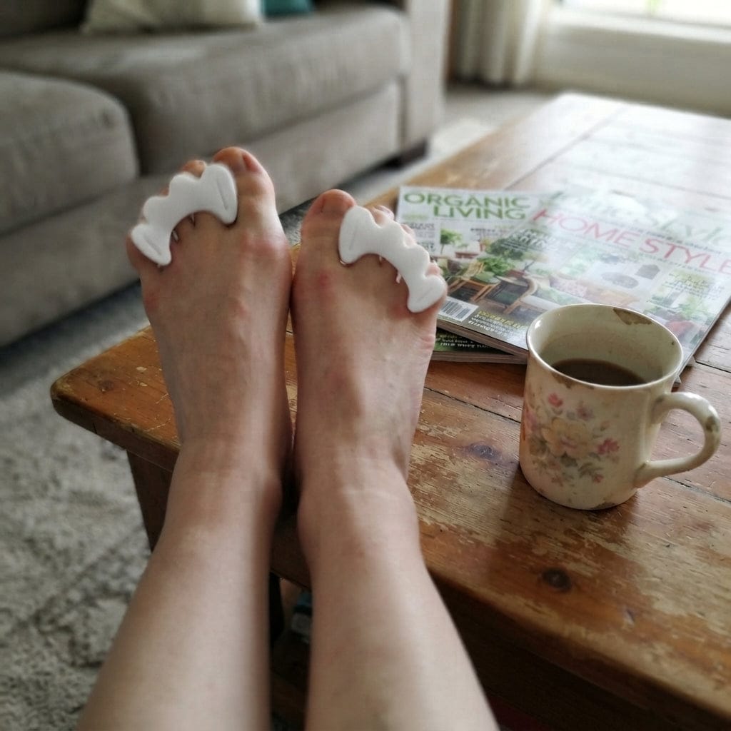 Customer photo review of Splae™ Complete Toe Reset Kit