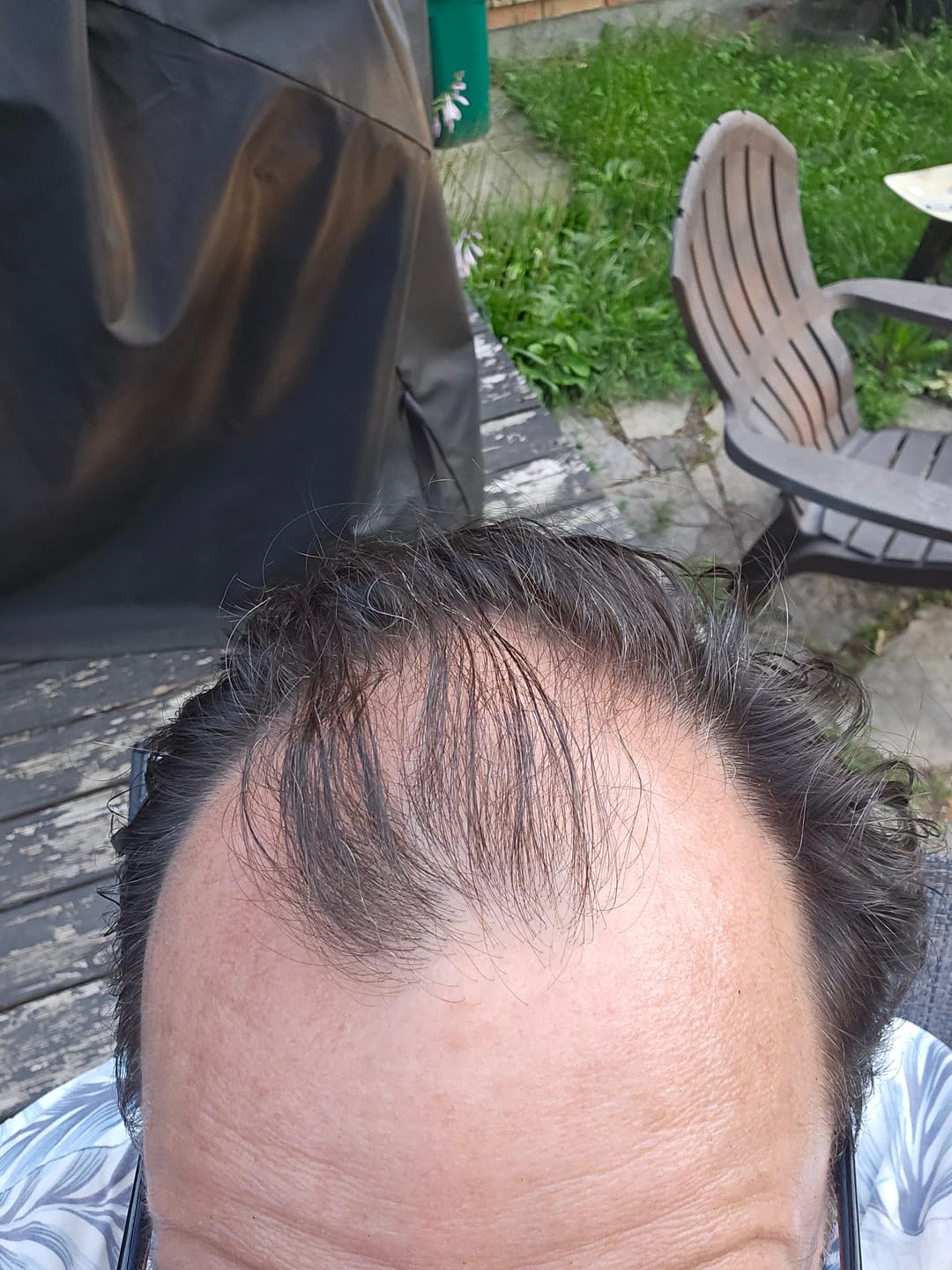 Customer photo review of Spartan™ Root Activator Shampoo 6 Bottles(sc)