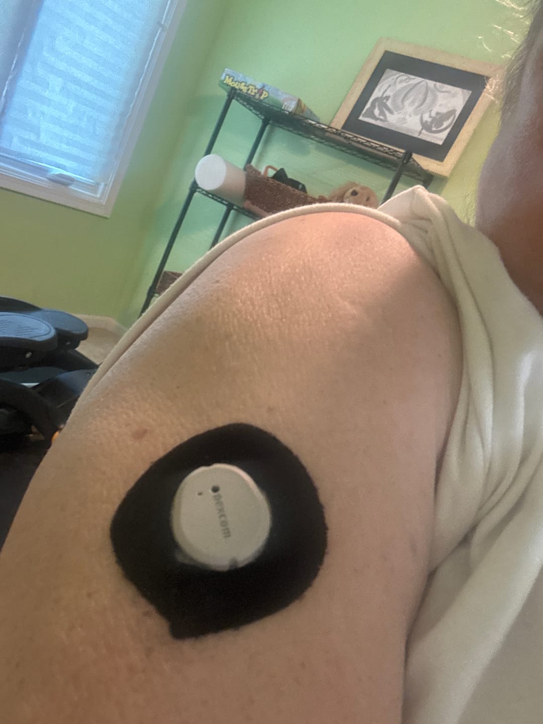 Customer photo review of Skin Grip Original - Dexcom G7 & Stelo Adhesive Patches (With Cutout)