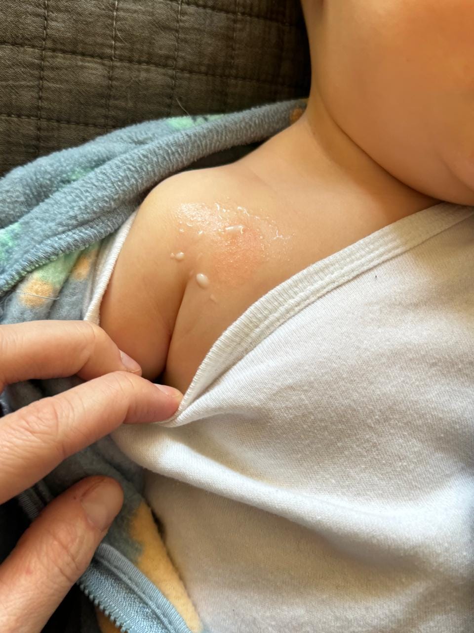 Customer photo review of Delicate Touch | Emulsión Recuperadora | Calmante |