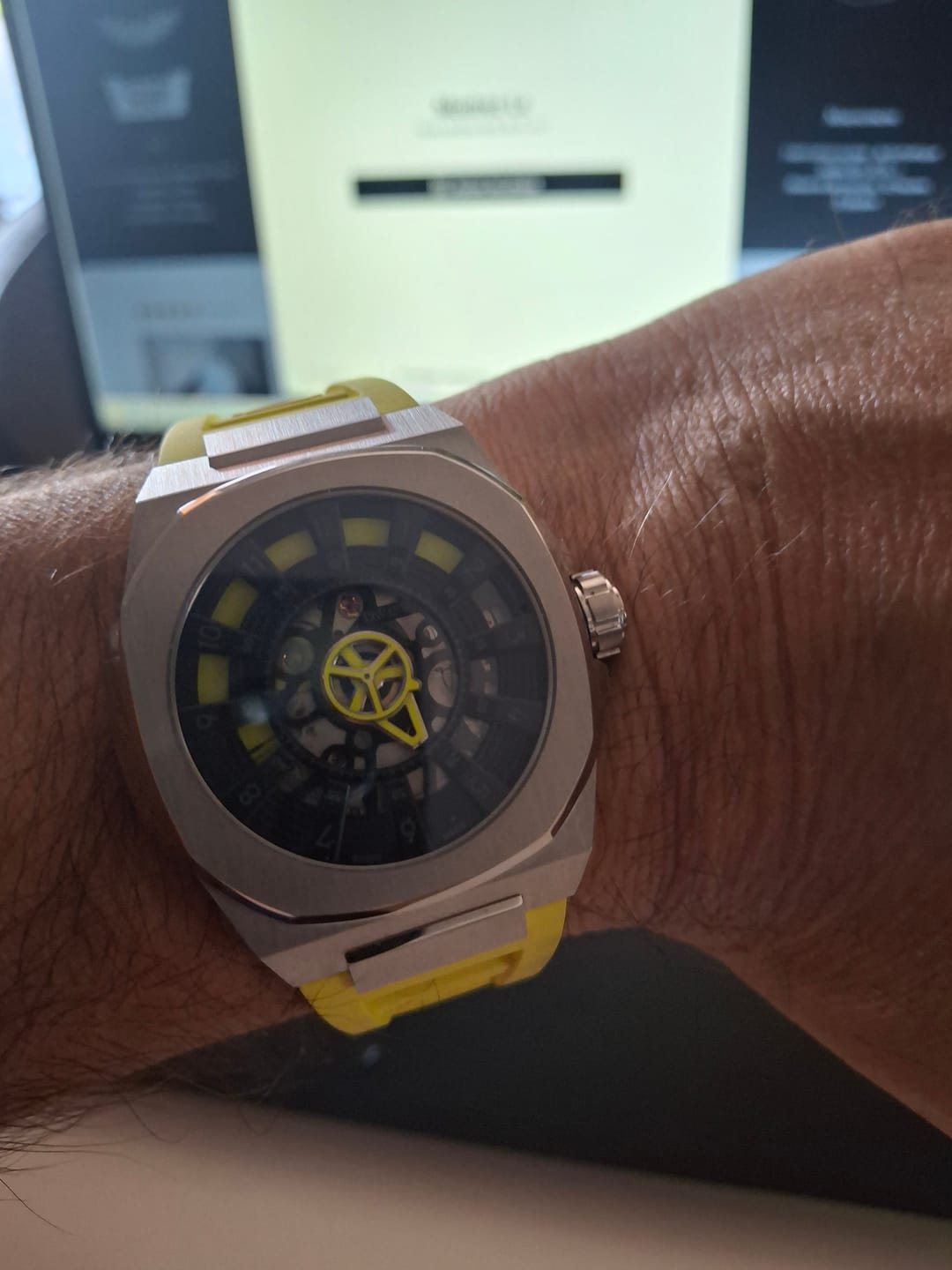 Customer photo review of M3S-blue-bracelet