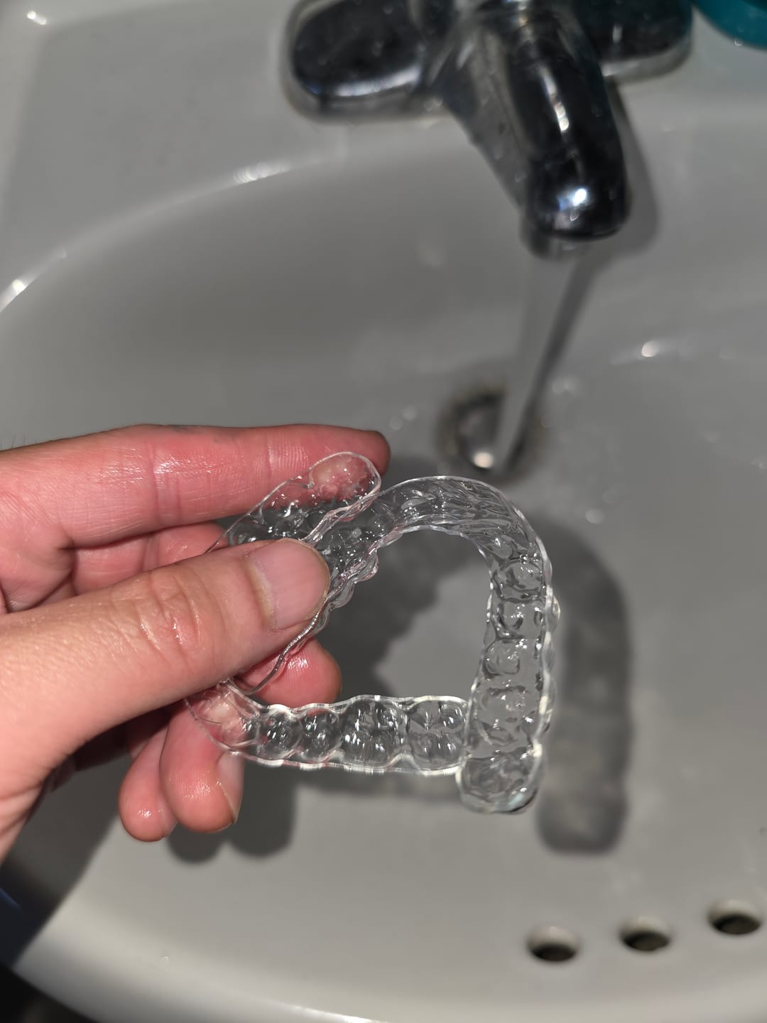 Customer photo review of Upper and Lower Retainers Set