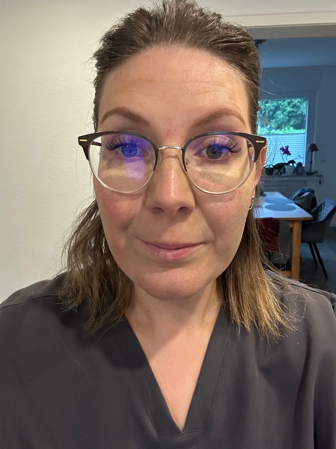 Customer photo review of Rosalique 3 in 1 Anti-Redness Miracle Formula SPF50