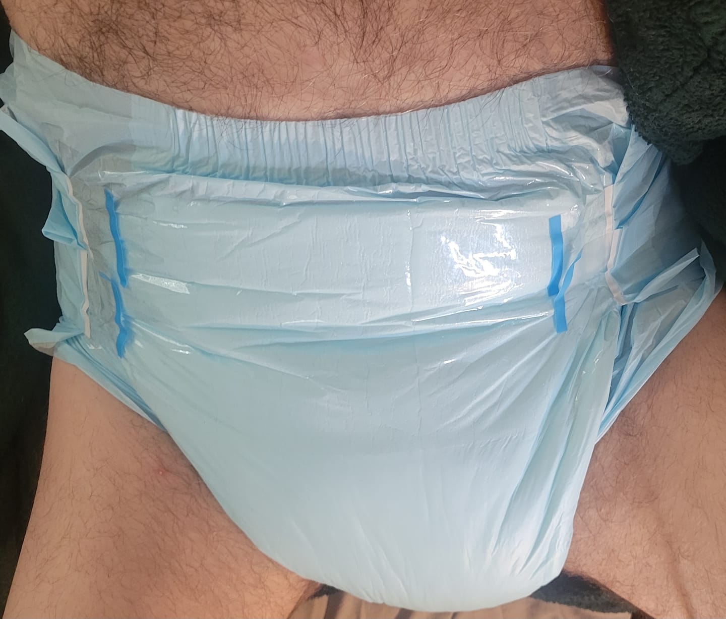 Customer photo review of SUNKISS Masterpiece Adult Diapers With Tabs