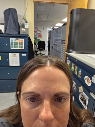A reviewer's close-up photo focusing on their forehead to show the effects of the Deep Collagen Cream.