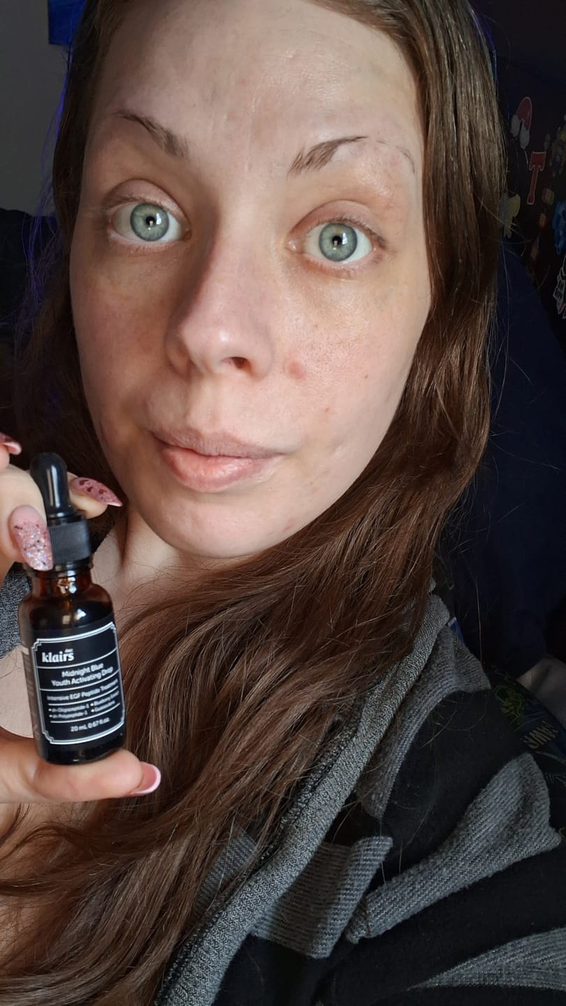 Customer photo review of EGF Blue Youth Activating Drop | EGF Peptide Serum