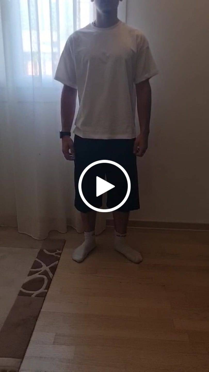 Customer video review of Pleated Baggy Jorts