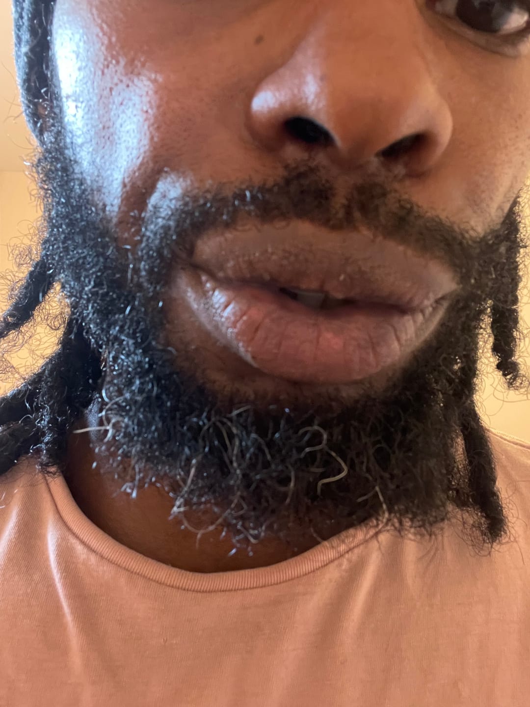 Customer photo review of Turmeric and Lemon Lip Balm (for Dark Lips)