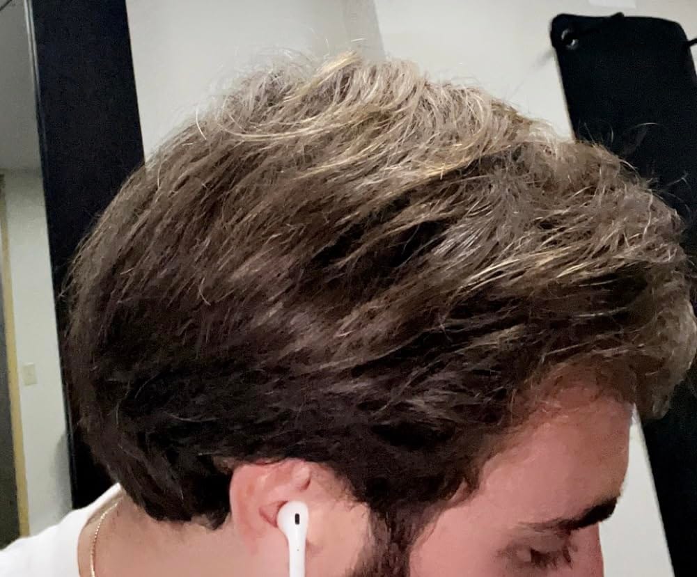 Customer photo review of Pepcobrix Sistema para el Crecimiento del Cabello