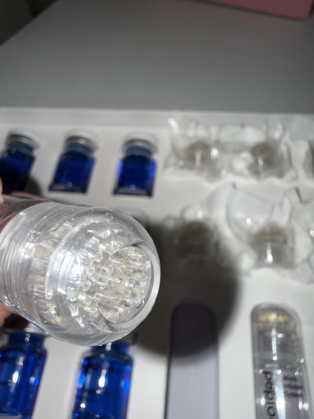 Customer photo review of Pepcobrix Sistema para el Crecimiento del Cabello