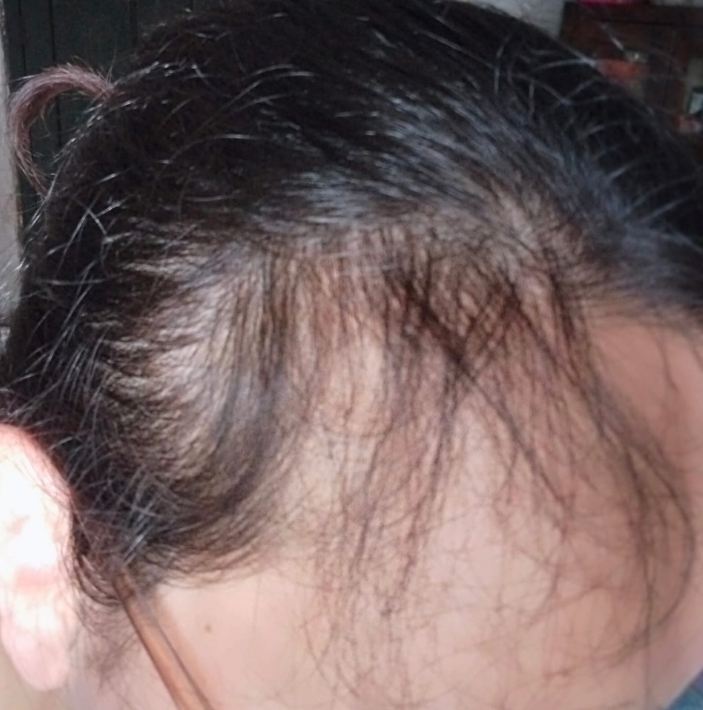 Customer photo review of Anagrow Hair Serum