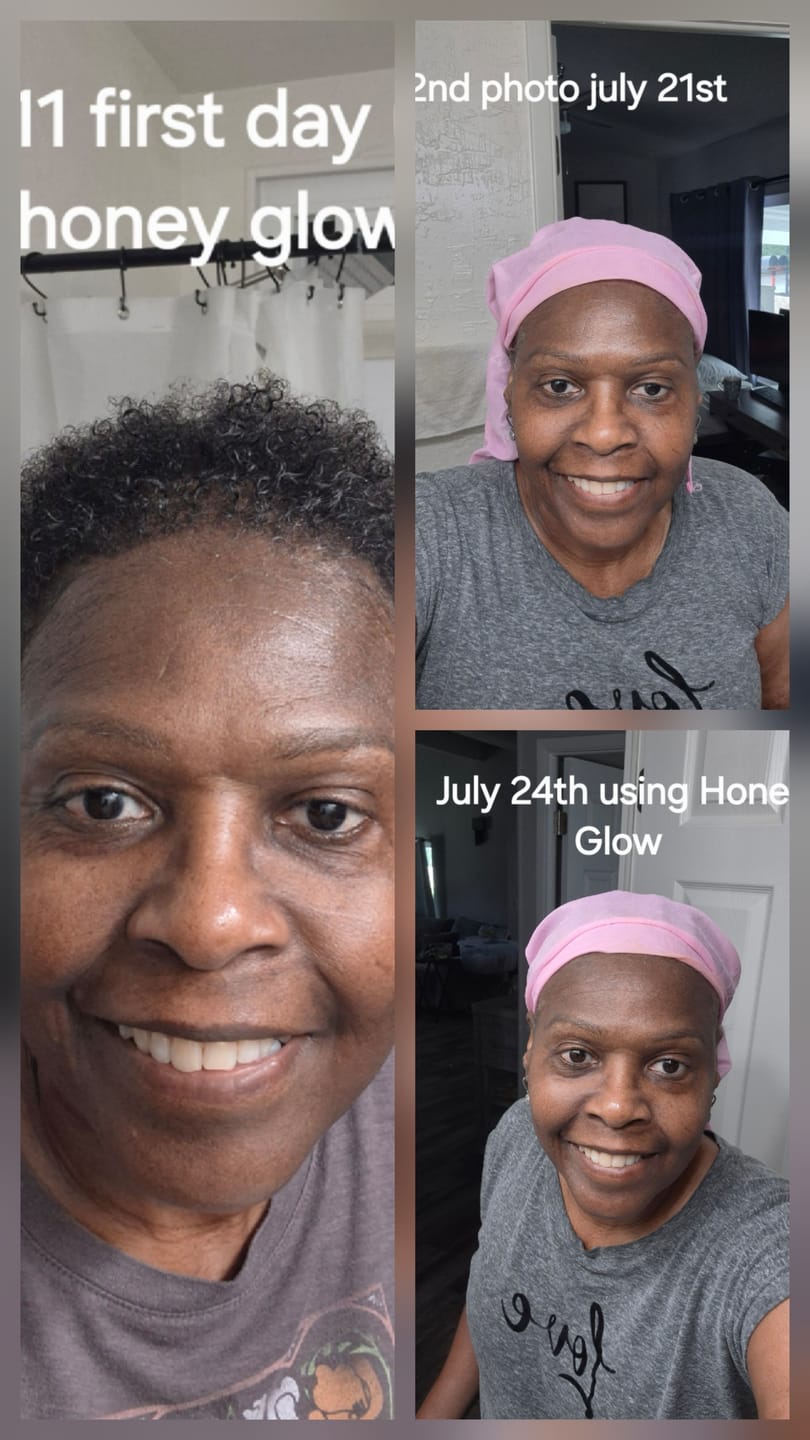 Customer photo review of Glow and Chill Bundle - Brightening Bar, Face Wash, Moisturizer, & Topical Magnesium Spray