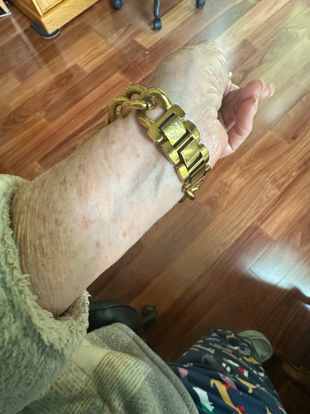 Customer photo review of Gold Woven Luxury Apple Watch Strap