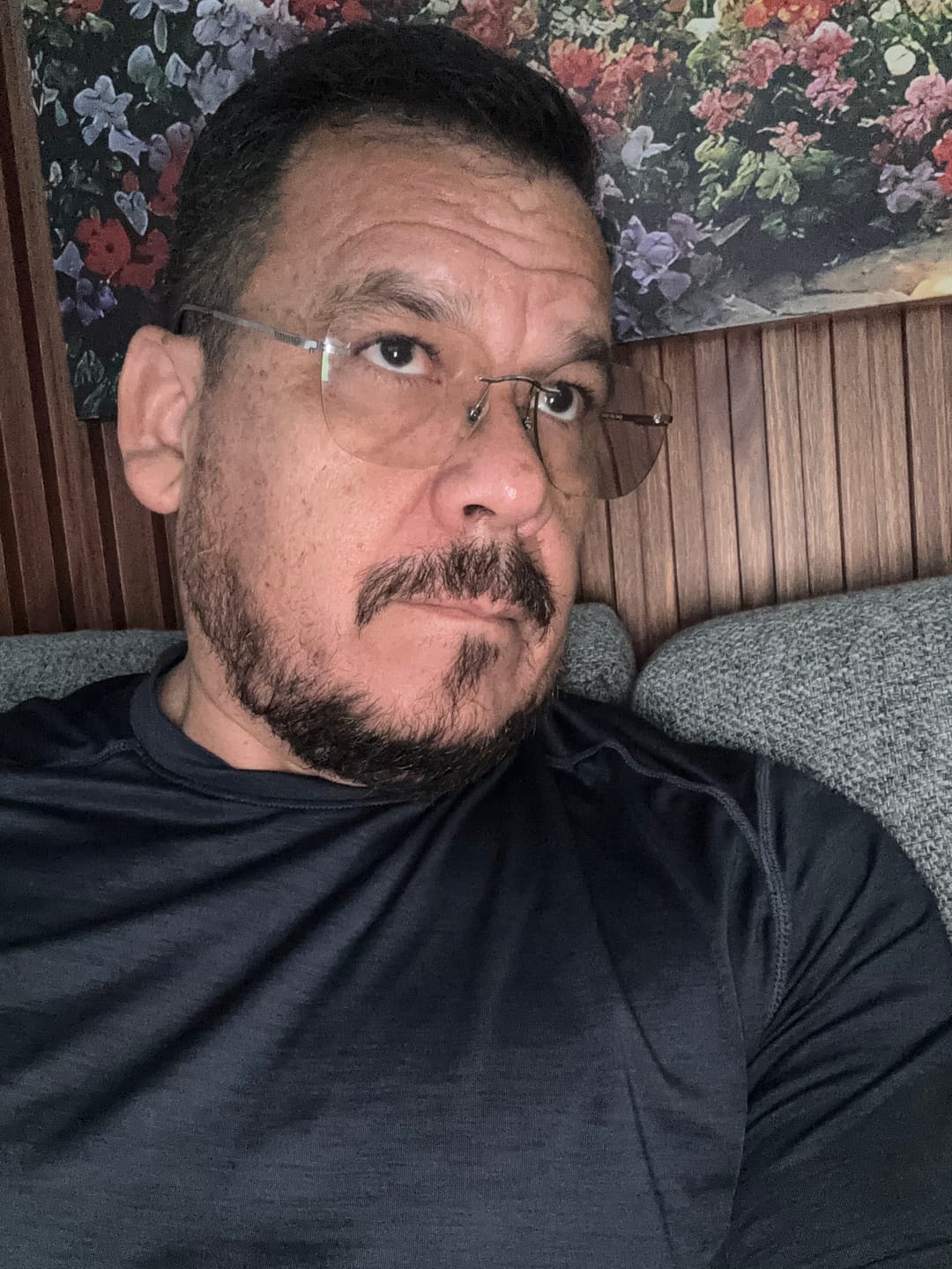 Customer photo review of Minoxidil al 20% | Espuma para Crecimiento de Barba. Formula Mejorada.