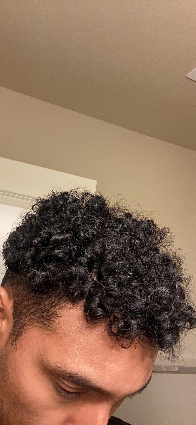 Customer photo review of Pepcobrix Sistema para el Crecimiento del Cabello