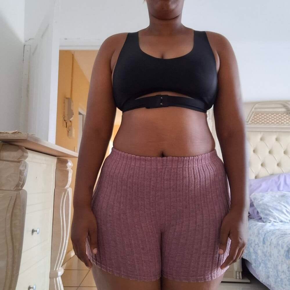 Customer photo review of Front Closure Cross-Back Wireless Posture Bra