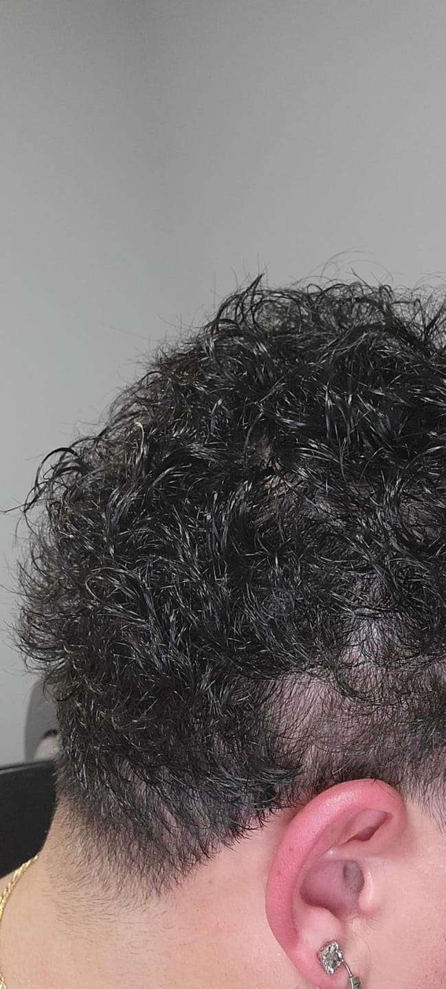 Customer photo review of Pepcobrix Sistema para el Crecimiento del Cabello