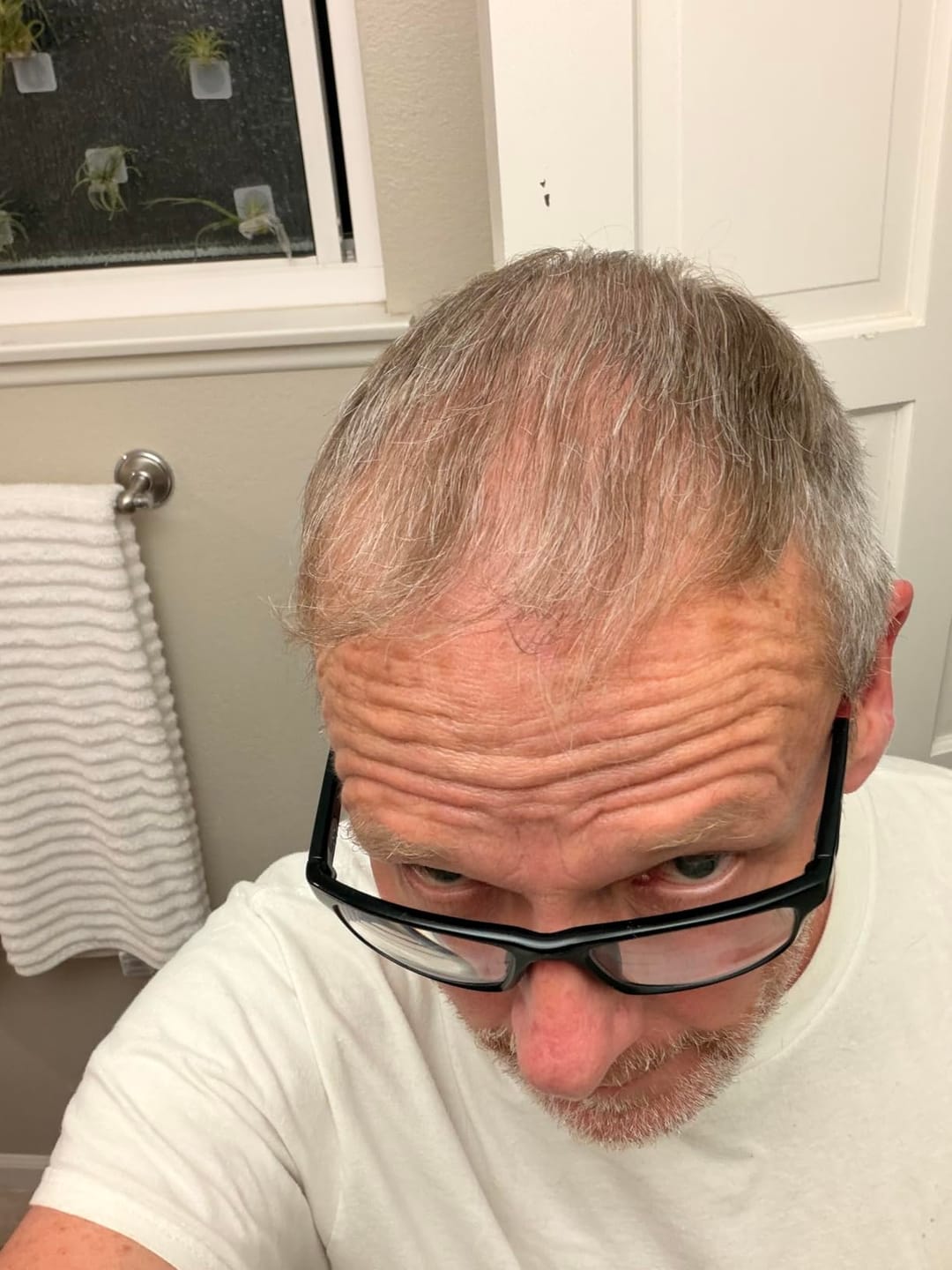 Customer photo review of Pepcobrix Sistema para el Crecimiento del Cabello