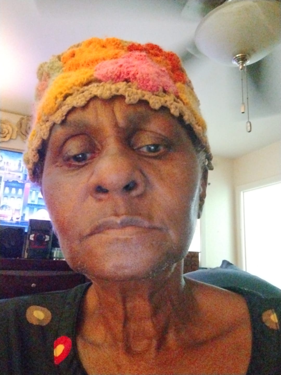 Customer photo review of Velura® Rotundus Therapy