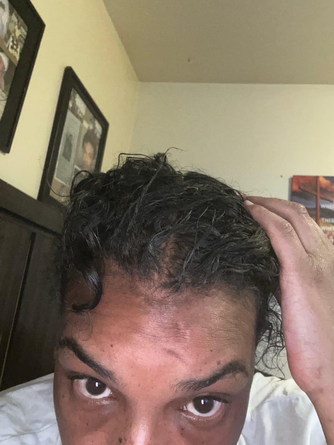 Customer photo review of Ultimate Hair Growth Bundle
