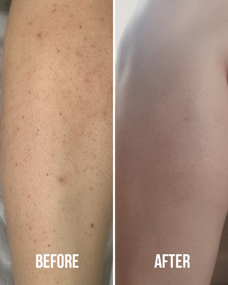 Customer photo review of Goda® Miracle Body Wash