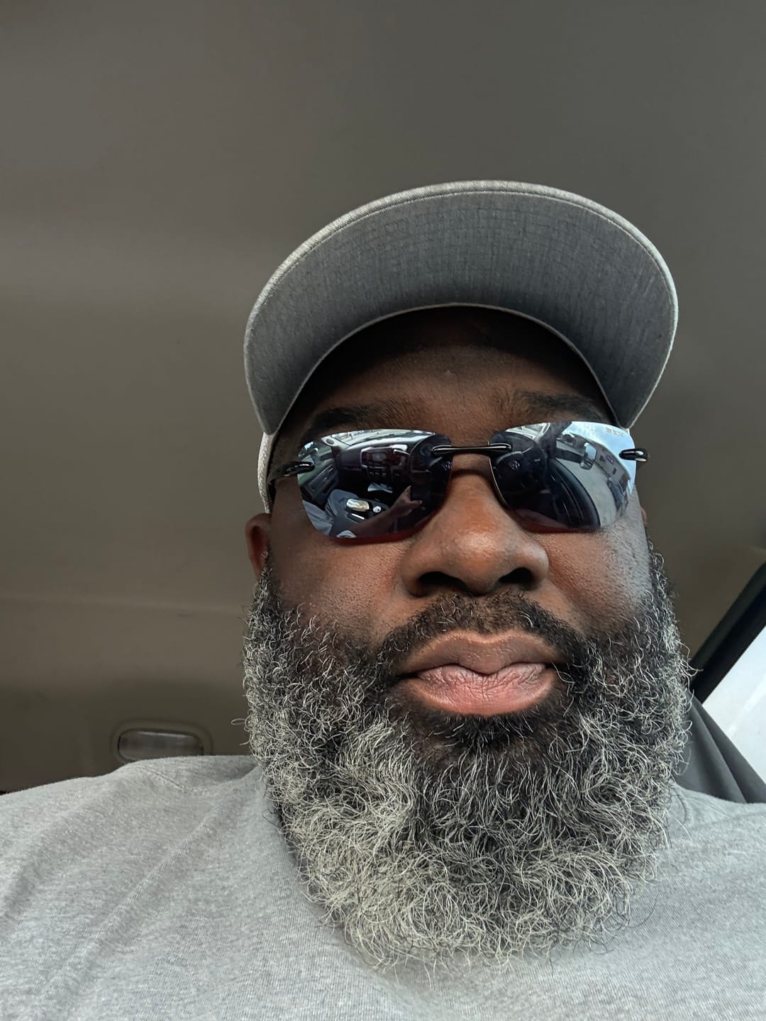 Customer photo review of Fade Cream (Fade Dark Marks)