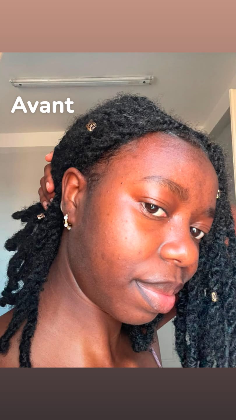 Customer photo review of Gel Nettoyant Purifiant Visage