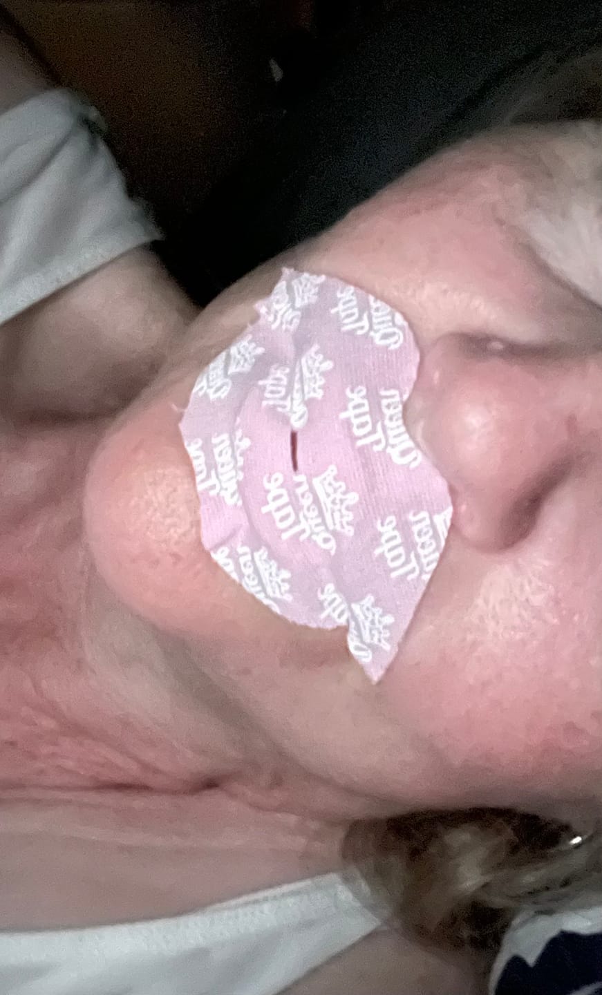 Customer photo review of Hydrating Plumping Collagen Mouth Tape - Crown Blush