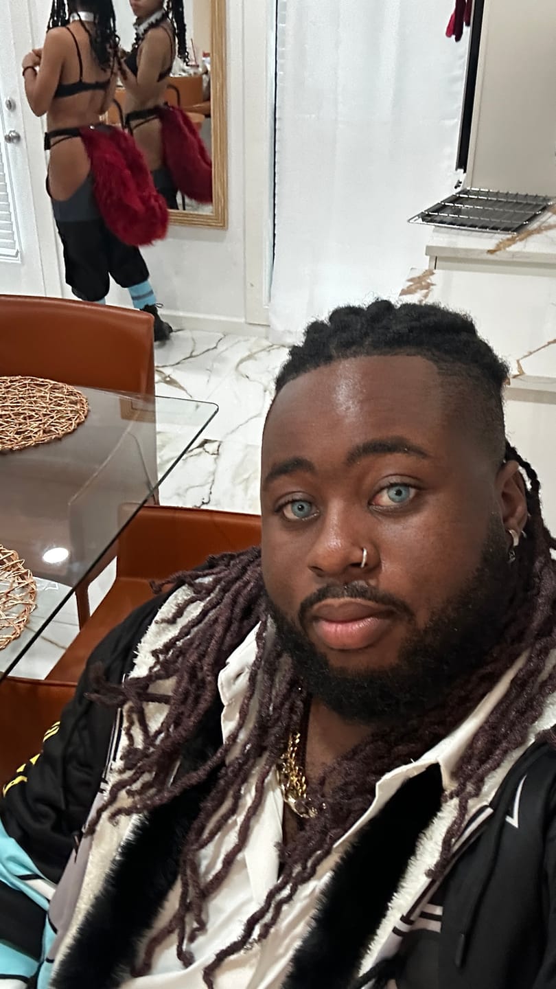 Customer photo review of New York Blue Prescription Colored Contact Lenses