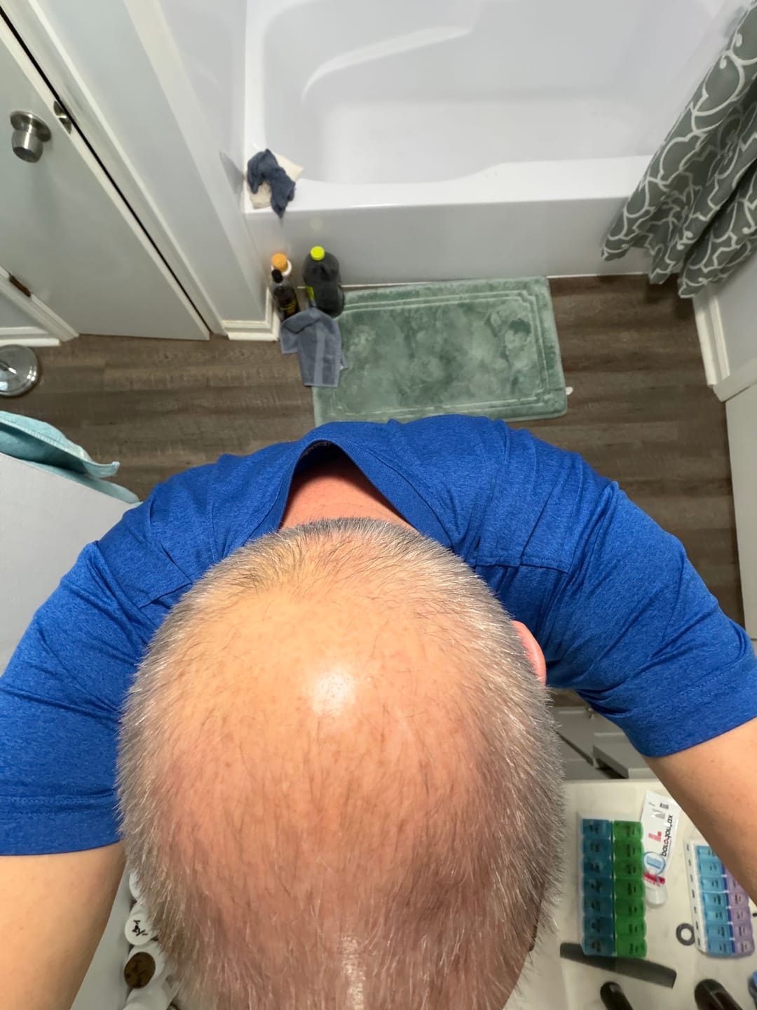 Customer photo review of 72% OFF: 1 Bottle Root Activator Shampoo (sc)
