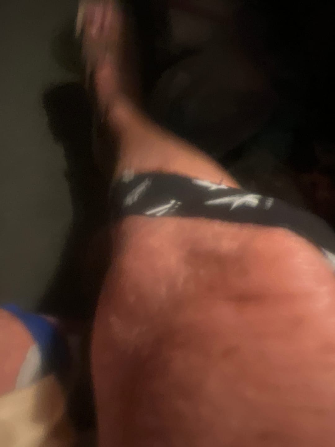 Customer photo review of A.LEAF MK-Tape, Stick It To Your Pain