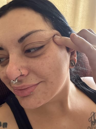 Customer photo review of Alpha-Arbutin + Vitamin C Brightening Bar