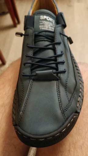 Customer photo review of Mia | Comfortable Orthopedic Sneakers