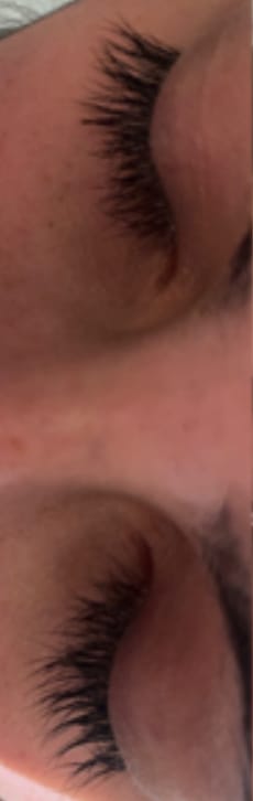 Customer photo review of LASH GROWTH SERUM
