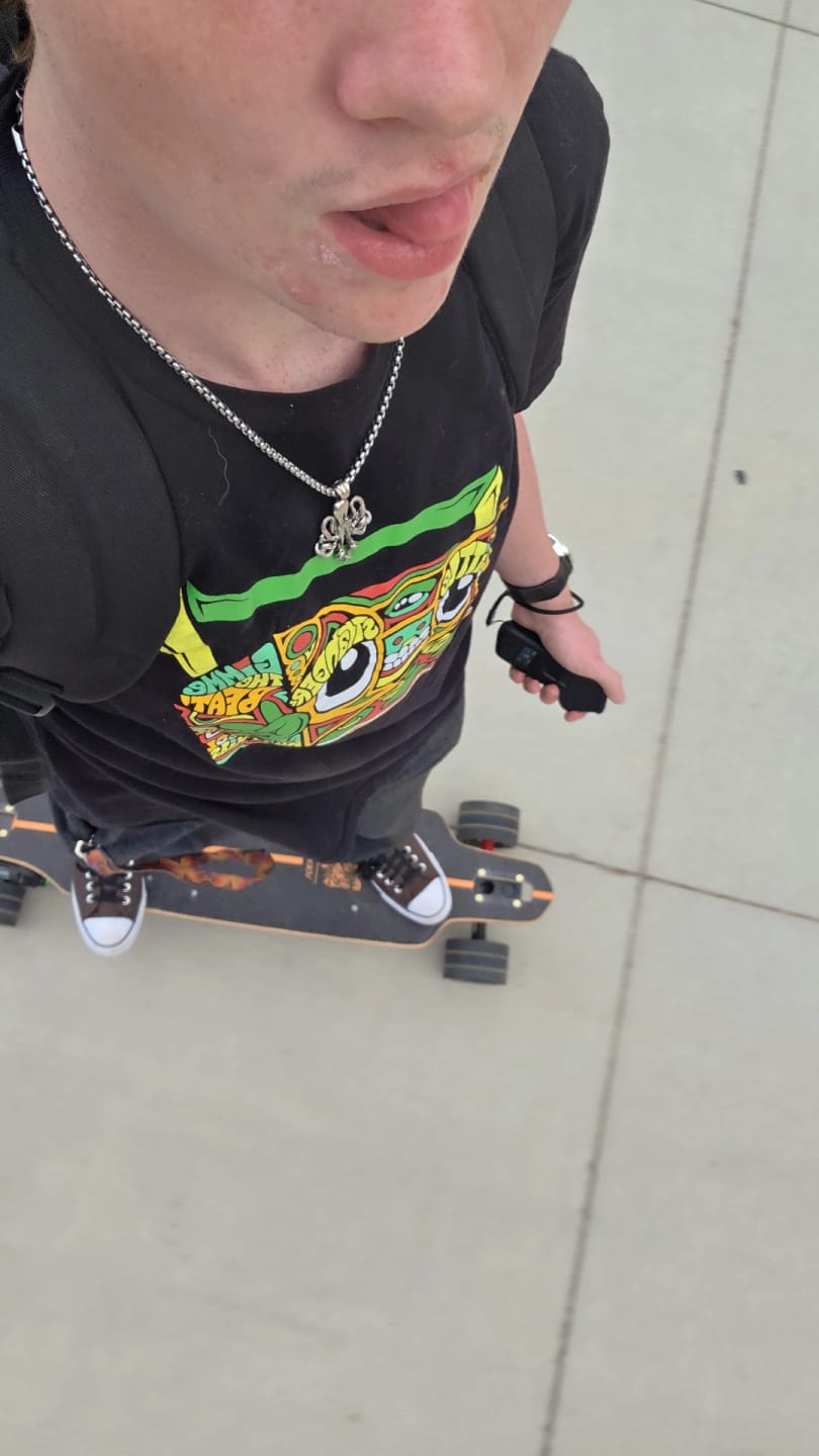 Customer photo review of CYBER ELECTRIC SKATEBOARD CONVERSION KIT