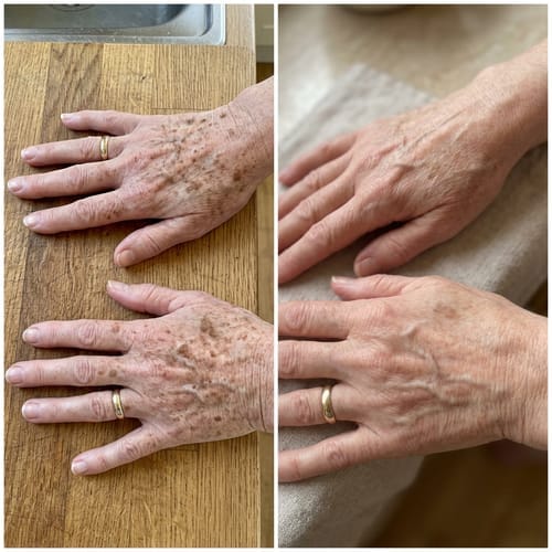 Customer photo review of Alpha-Arbutin + Vitamin C Brightening Bar