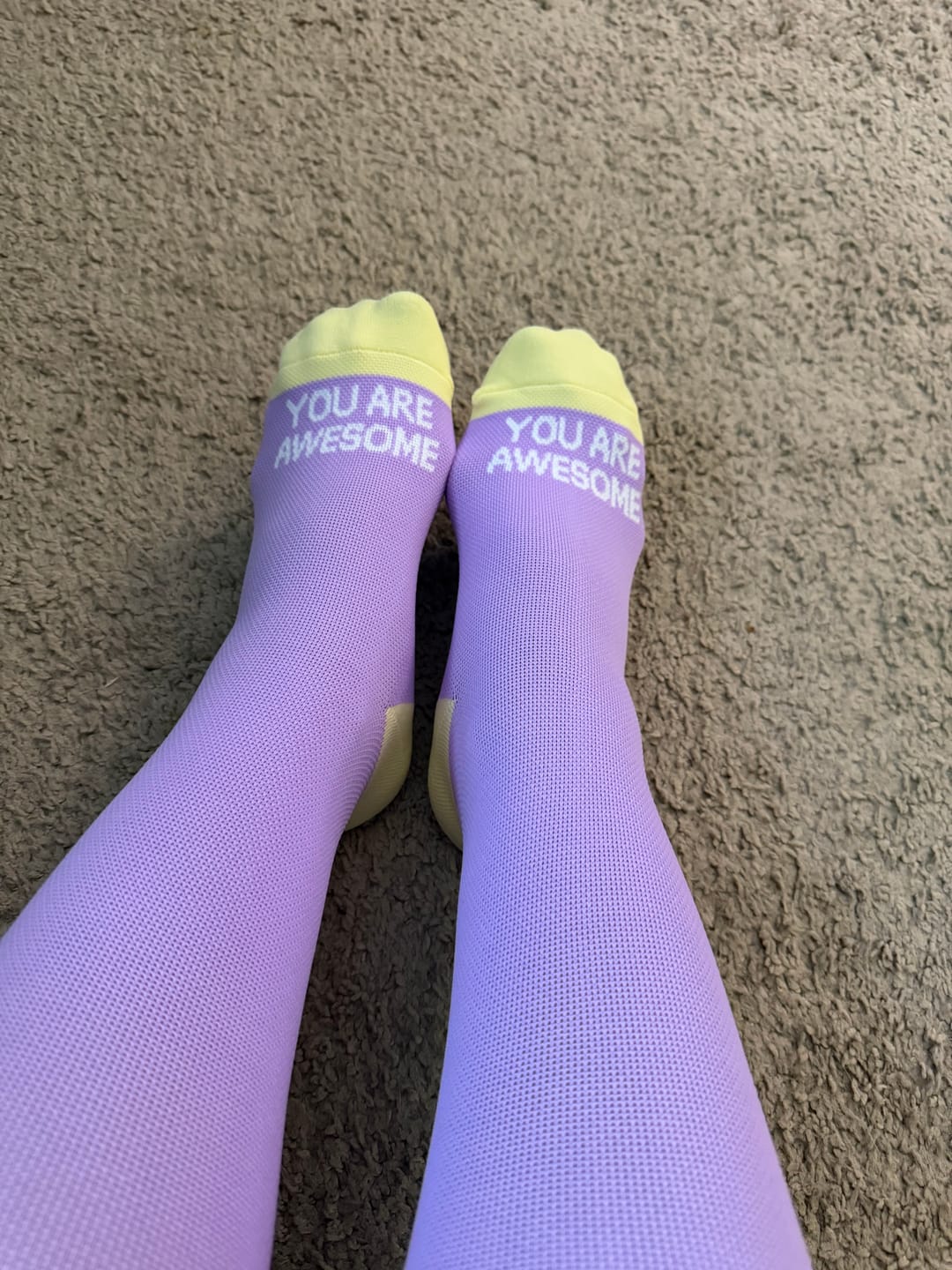 Customer photo review of NurseStrong Performance Compression Socks