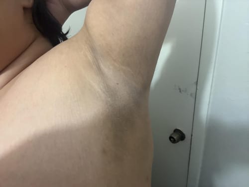Customer photo review of Alpha-Arbutin + Vitamin C Brightening Bar