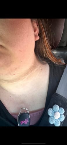 Customer photo review of Alpha-Arbutin + Vitamin C Brightening Bar