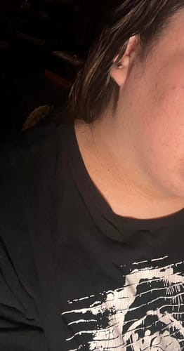 Customer photo review of Alpha-Arbutin + Vitamin C Brightening Bar